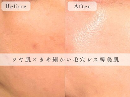 セローナ(Selona)の写真