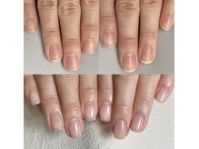 イズム(Izm)/上before/下after