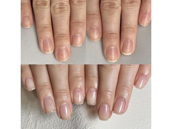 イズム(Izm)/上before/下after