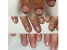レ クーラ(Le cura)の雰囲気（短爪、噛爪、割れやすいなどのトラブル爪に対応した深爪ケア◎）