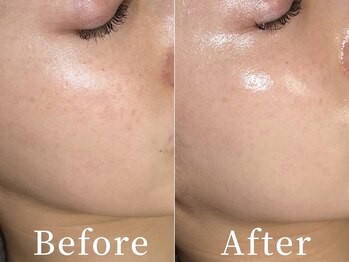 ユカリス(Yu.charis)の写真/年齢とともに目立つ毛穴悩みに。徹底洗浄と引き締めケア