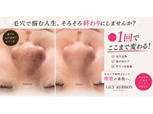 リリーリボン(LILY REBBON)