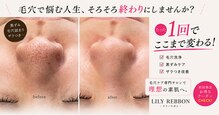 リリーリボン(LILY REBBON)