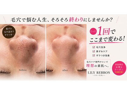 リリーリボン(LILY REBBON)の写真