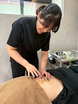 グロウアップ鍼灸整骨院 ベイシア彦根(GROWUP鍼灸整骨院)の写真/鍼灸施術を受けたい方へ。心地よい整骨院でプロのケアを体験しませんか♪