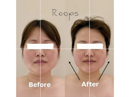 ループス(Roops)の写真