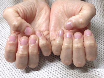 深爪解消クリアジェルネイル