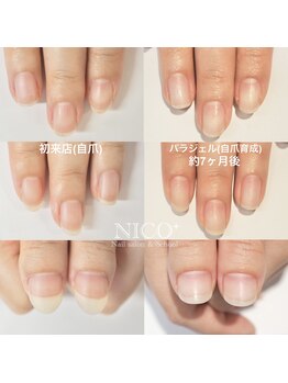 ニコプラス(NICO+)/自爪育成パラジェルクリア補強