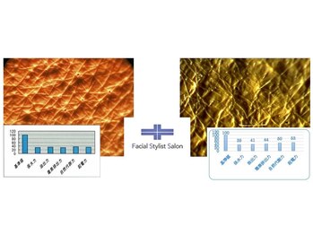 フェイシャルスタイリストサロン 高崎店(Facial Stylist Salon)/キメのケア例(2)