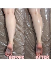 シェリー 紺屋町店(Cherie)/脚のリンパをしっかり流します♪