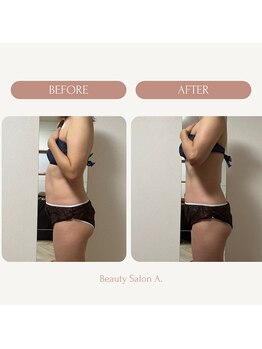 エードット 銀座(A.)/before → after