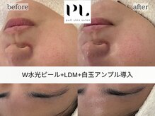 プル スキンサロン(pull skin salon)/