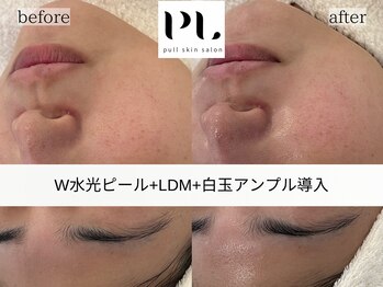 プル スキンサロン(pull skin salon)/