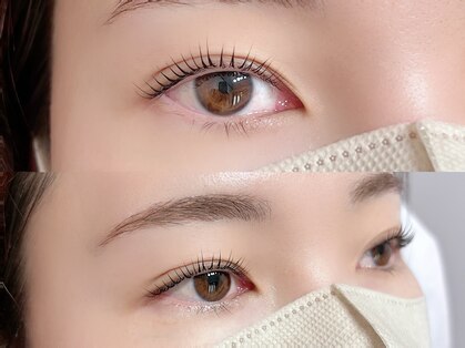 アール(R)の写真