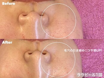 ルチア 博多店(Lucia)/今話題の韓国肌管理♪