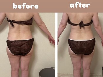 ヨサパーク メリー(YOSA PARK merry)/劇的変身コース1回目の変化