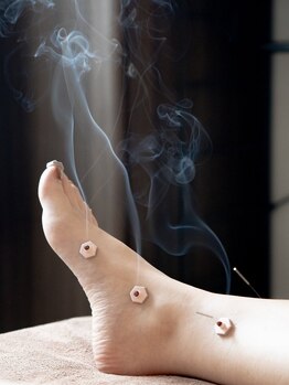 ひとはり/冷え性改善