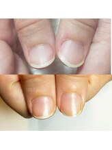 キュア(Cure.)/自爪育成専門店だからこその整爪