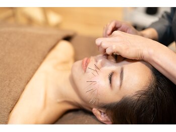 鍼灸パルシェ/美容鍼