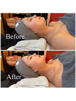 アトリエ ネリネ(Atelier neRine)/ハリのあるお肌に