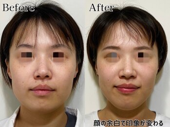 プルチャームエテルナ 代官山店(Pulchram eterna)/ライン矯正+リンパ+機械