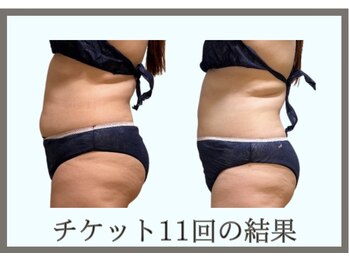 ヨサパーク コクリ(YOSA PARK kokuRi)/ぽっこりお腹を卒業!