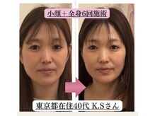 ローズモモの雰囲気（★男性脳に響くお顔に変身するのは全身からの施術が必須です!）