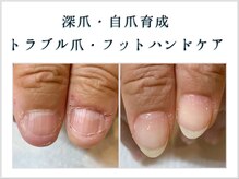 つめびより トラブルネイル研究所 柏 by doue