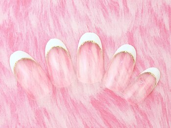 エスディーアイ(SDI)/フレンチ