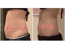 クレアボディ(CREA BODY)/お腹