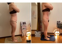 ディオネ/痩身ビフォーアフター【6ヶ月】