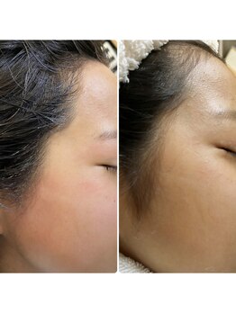 カピリナ(ka pilina)/フェイシャルワックス