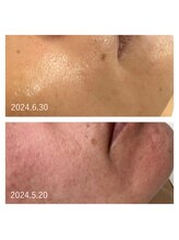 ヨリ(yori)/レストセル2回・マーメイド1回