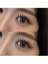 ベリーニ(Be.llini.)/バインドロック100束