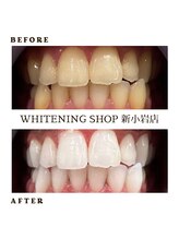 ホワイトニングショップ 新小岩店/ホワイトニング専門店