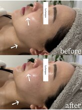 ラ フォルポ 恵比寿(La forepos)/verunaハーブピーリン恵比寿