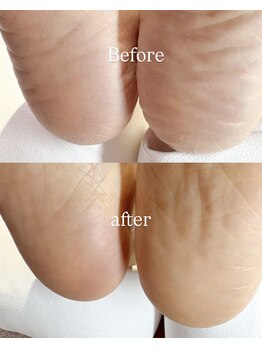 メリーミー(Merry me)/フットケア