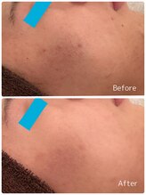 ククル(KUKULU)/ハーブ7回目♪（20代男性）