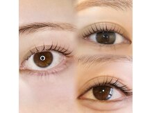 カウンセリングを通して理想のお目元へ