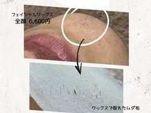 サンカリビューティー(SANKARI beauty)