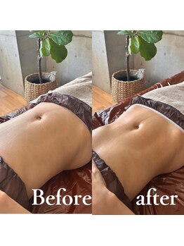 スリラ(SuriLa)/◆ビフォーアフター◆