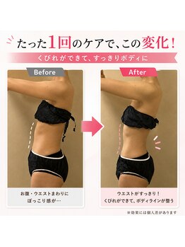 ボディーコード 新所沢店(BODY CODE)の写真/【本気で痩せたい方必見】ラジオ波×体質分析で、気になる部位を徹底ケアして理想のサイズダウンへ♪