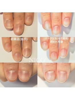 ニコプラス(NICO+)/自爪育成パラジェルクリア補強