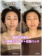 エリーザベル(Elisa Bell)/小顔矯正コルギ