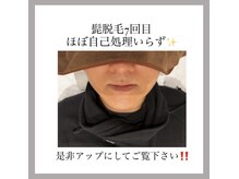 オークツリー(oak tree)/魅せる髭脱毛