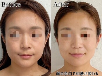 プルチャームエテルナ 代官山店(Pulchram eterna)/ライン矯正+リンパ+機械