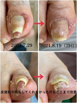 一宮巻き爪センター/巻き爪