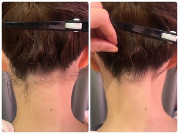 エステティックサロン アールグレー/シェービング比較写真