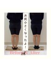 スタイルラボ高松/産後の骨盤矯正の効果♪