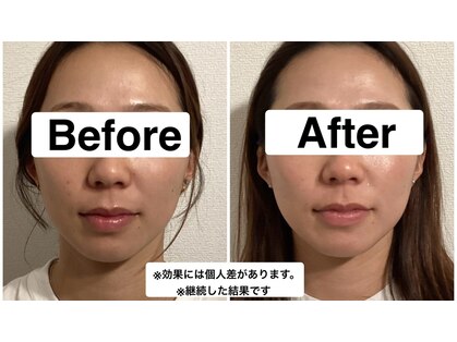 グリーン鍼灸整体院(green鍼灸整体院)の写真